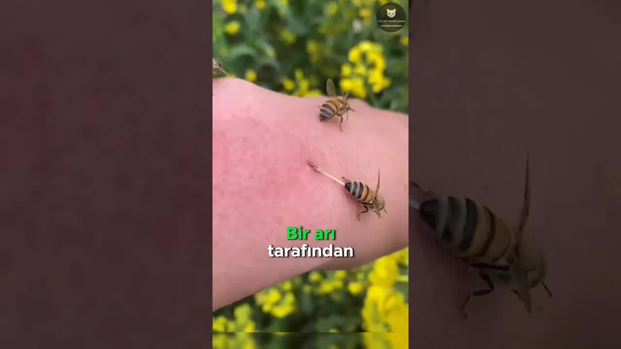 Arı Soktuğunda Yapmanız Gerekenler