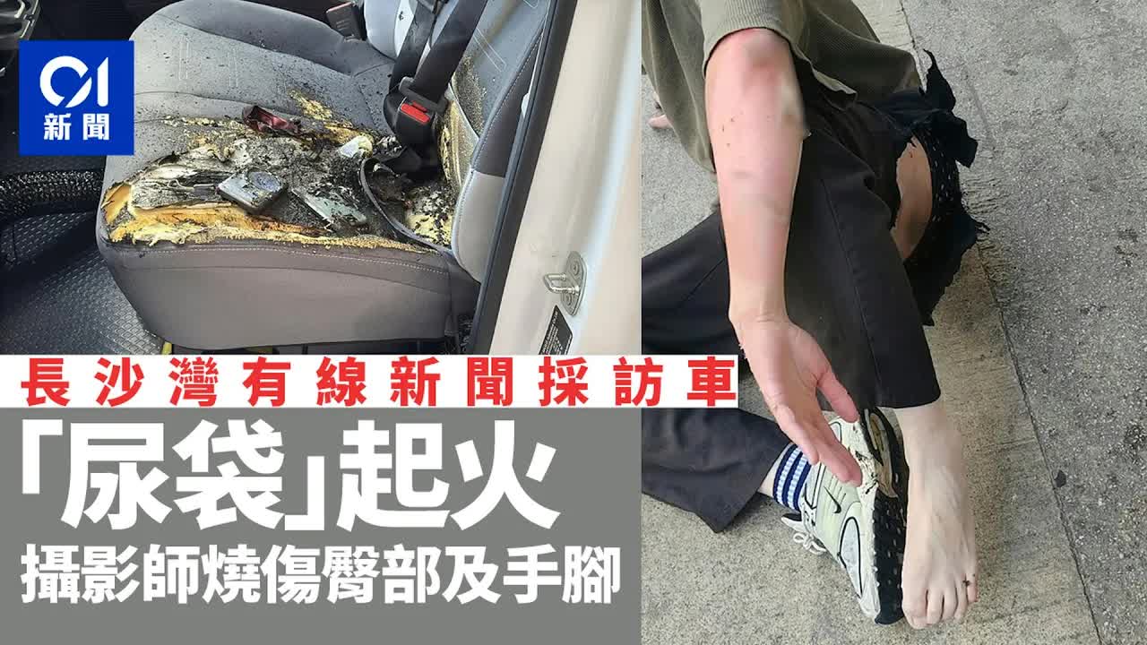 有線新聞採訪車尿袋起火攝影師燒傷