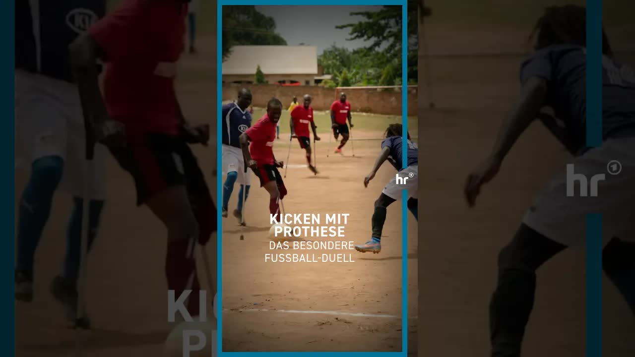 Hassan gewinnt mit neuer Prothese ein Stück Leben zurück
