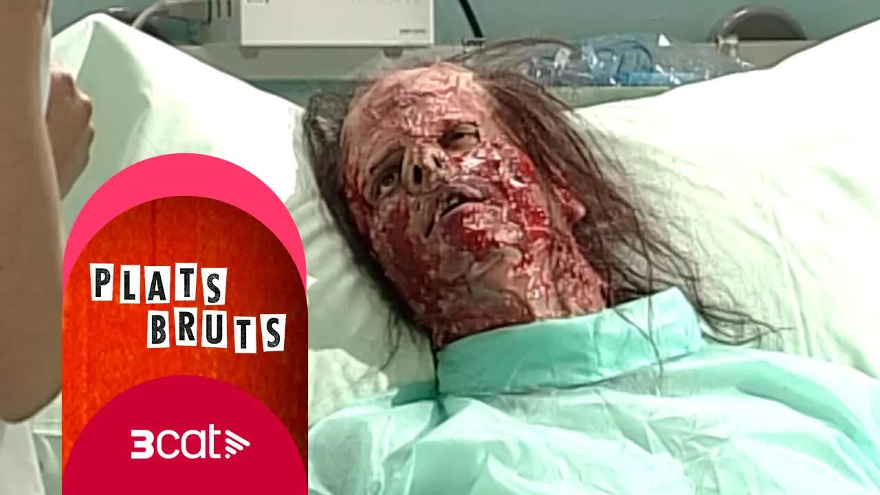David es converteix en heroi televisiu després d'un accident