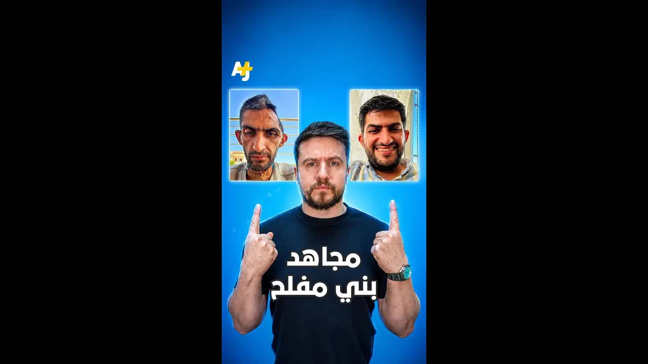 شاهد قبل وبعد لأسير فلسطيني بعد الإفراج