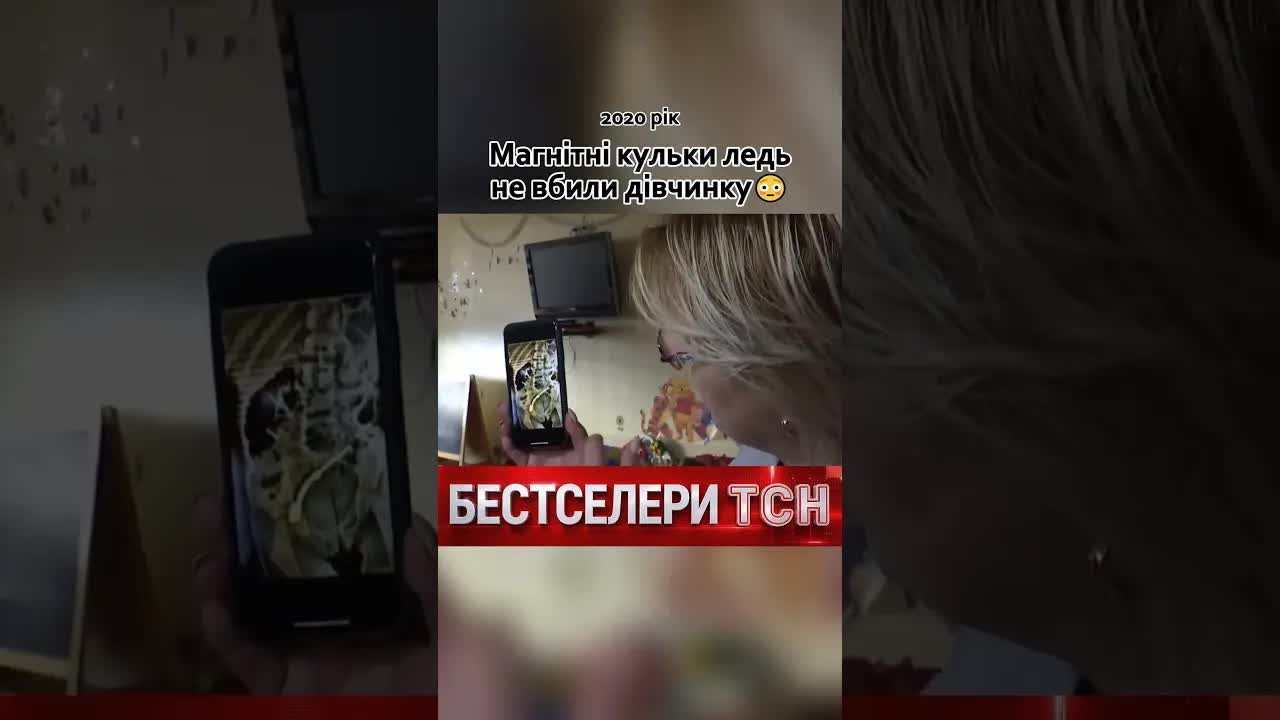 Магнітні кульки ледь не вбили дитину