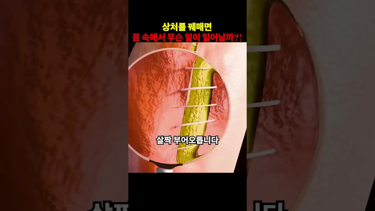 상처 치유 과정 속 몸의 변화