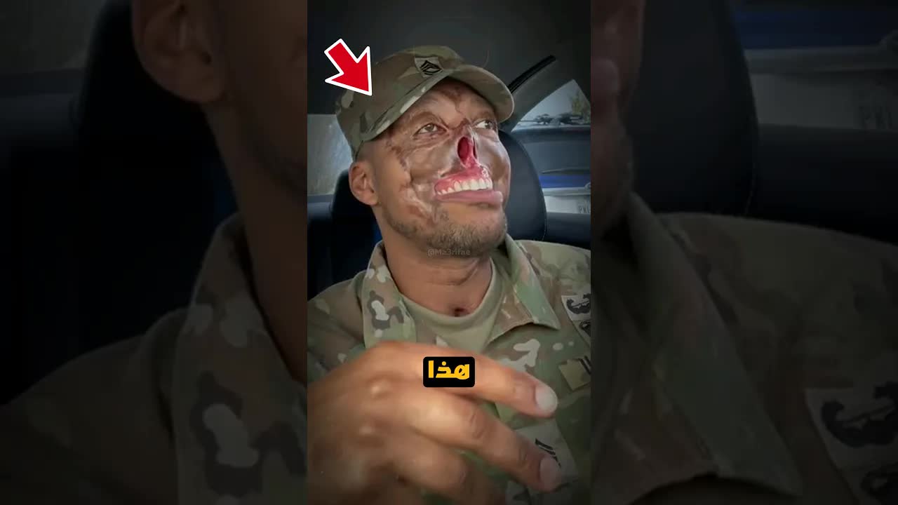 رجل يُنقذ أرواحًا ويُصاب بجروح خطيرة