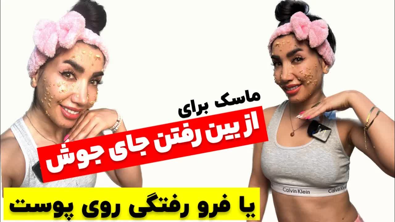 ماسک خانگی برای درمان جوش و آکنه