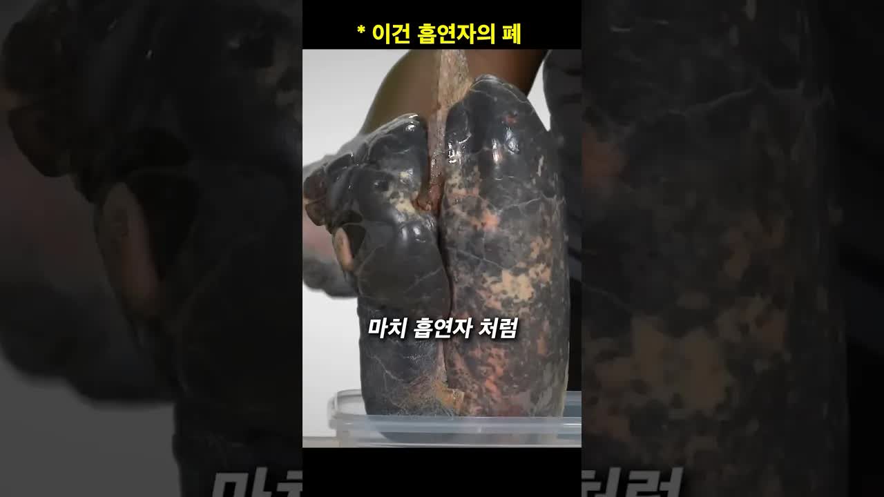 미세먼지 속 달리기의 폐에 미치는 영향
