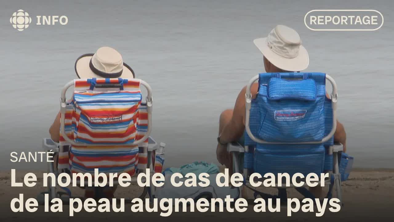 L'augmentation des cas de cancer de la peau au canada