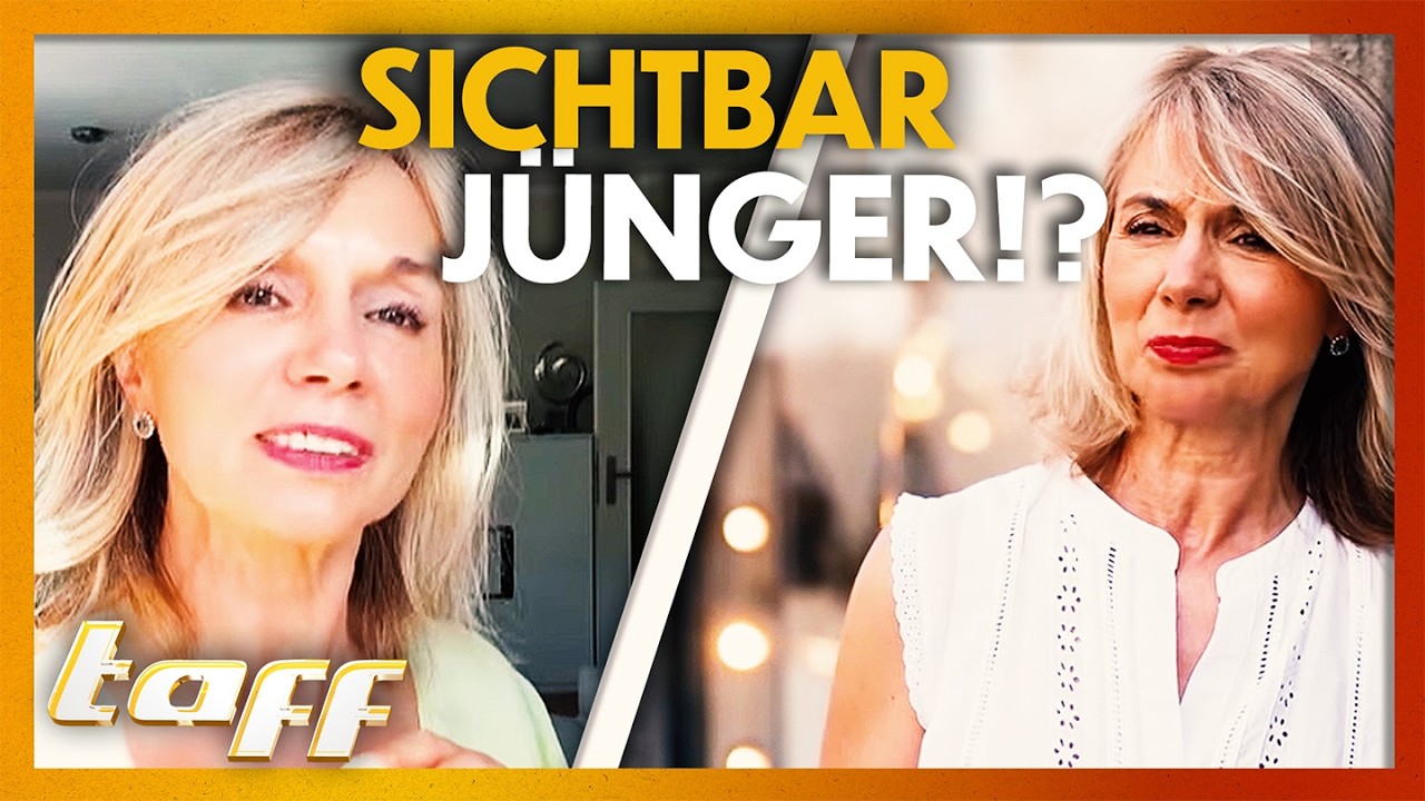 Peptide statt Botox: Der Falten-Test