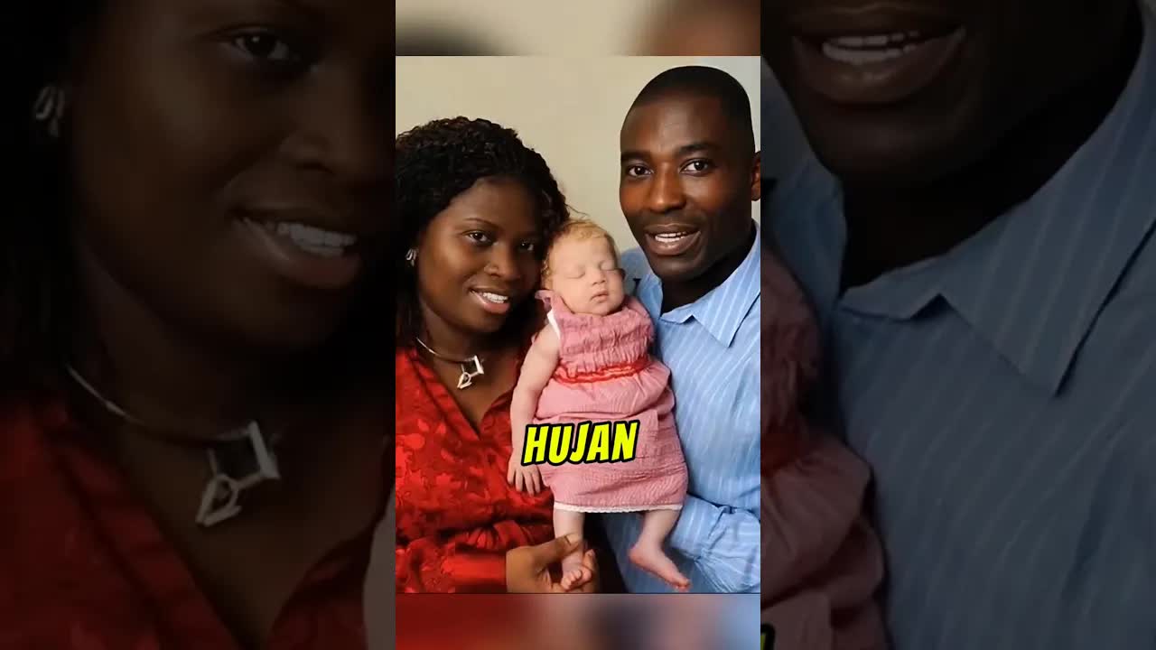 Kisah Bayi Putih Dari Ibu Bapa Coklat