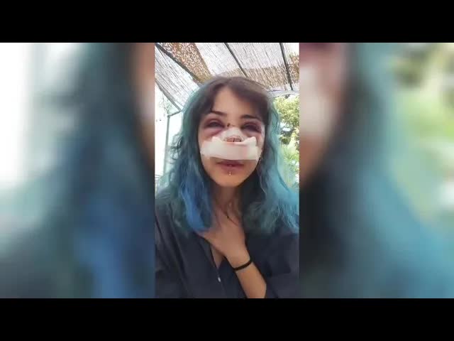 Grazie per il sostegno dopo l'aggressione