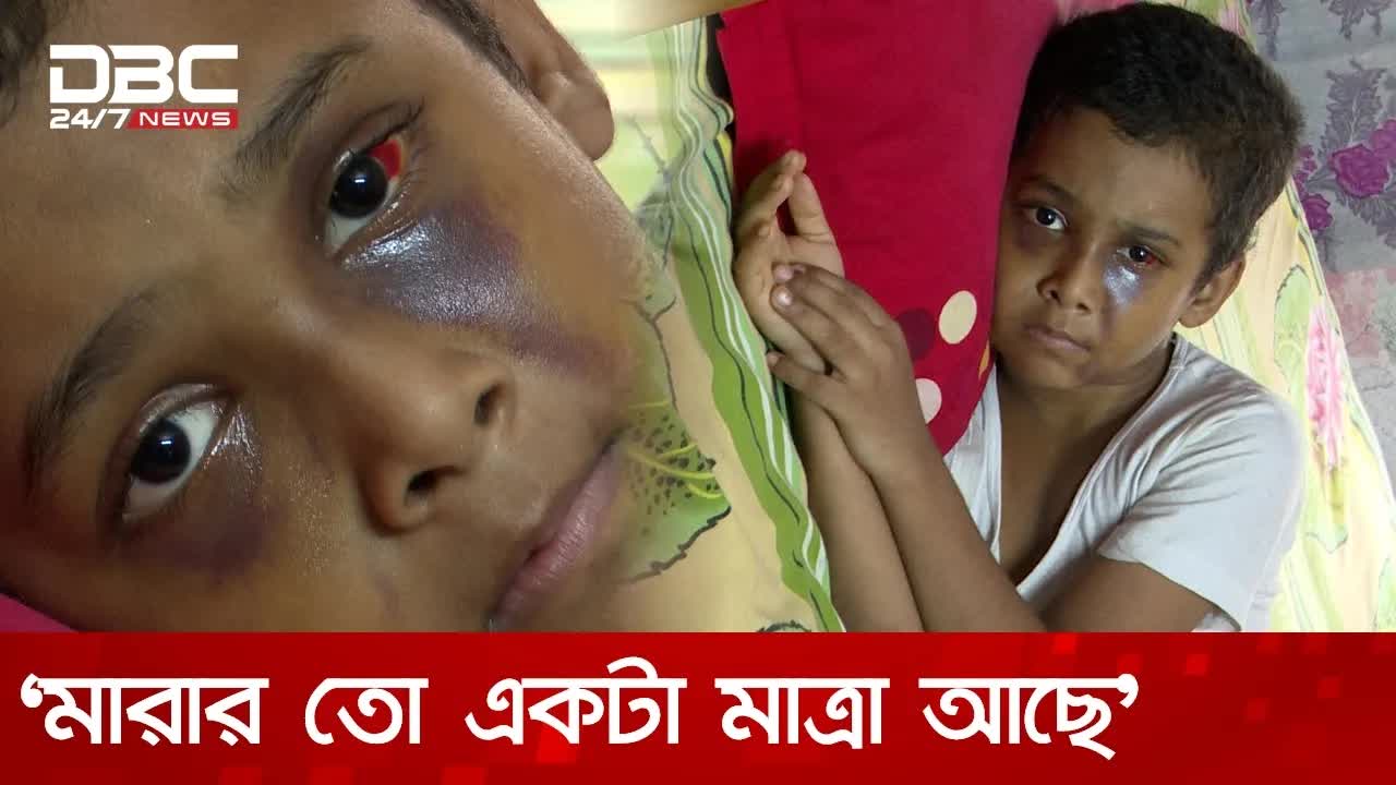 ৯ বছরের শিশুকে মারধর: মাদ্রাসা শিক্ষকের বিরুদ্ধে মামলা