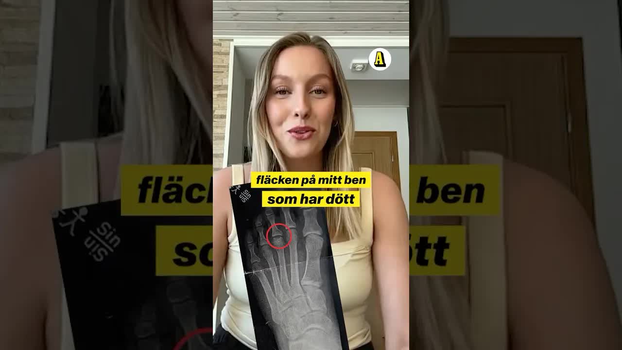 Adlaine Mårtensson: Min fot har dött