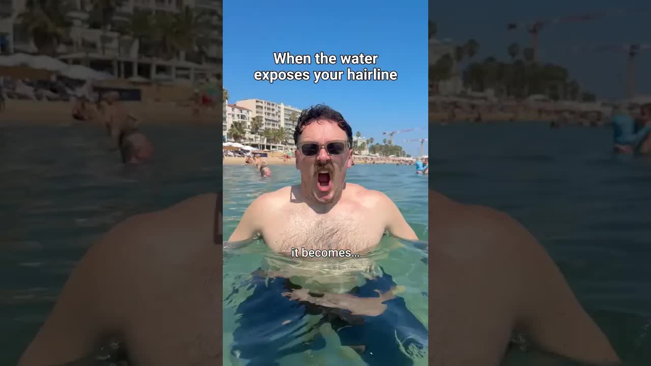 Water, hairlines and awkward holiday moments