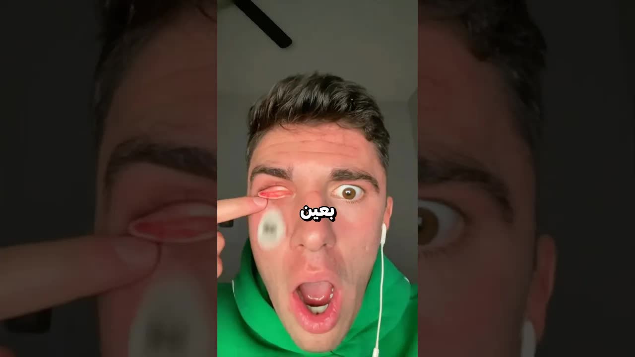 هذا الرجل حوّل عينه إلى شاشة خضراء!