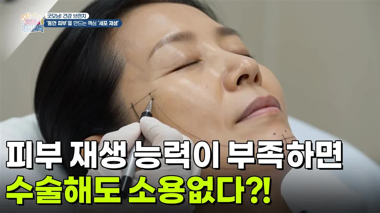 피부 재생 능력이 부족하면 수술해도 소용없다