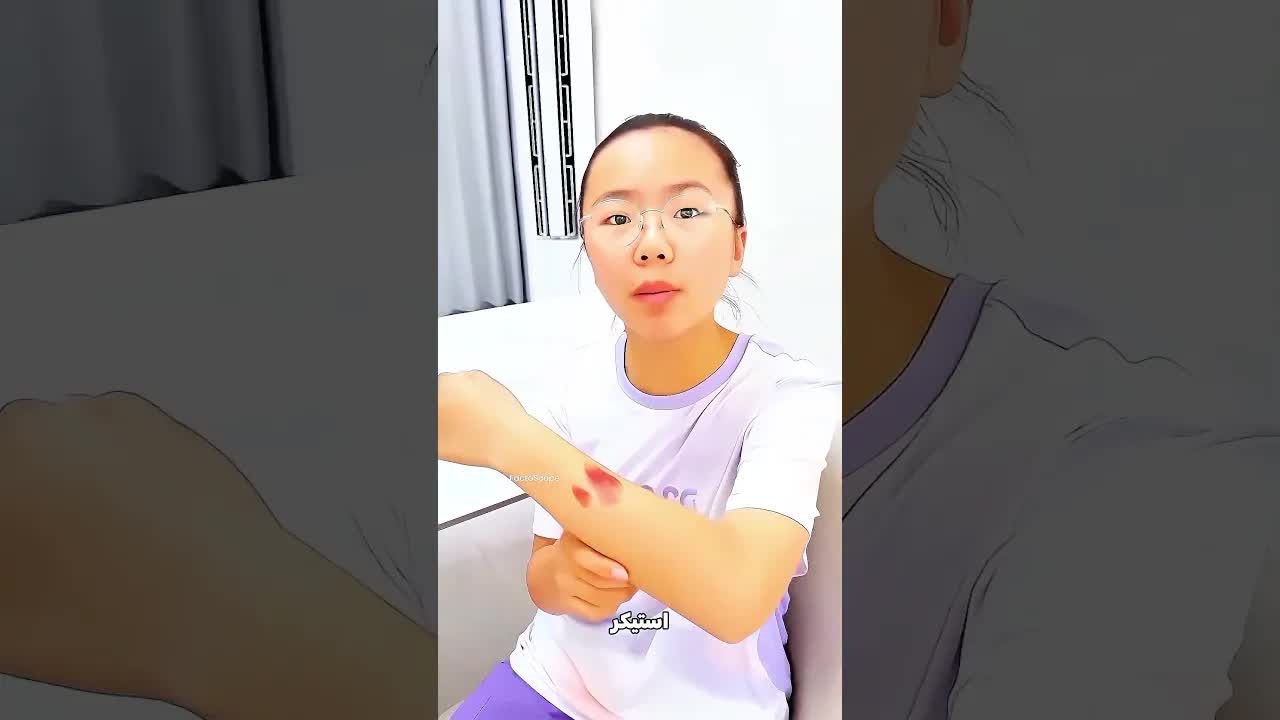بنت حطت جروح مزيفة عشان متروحش المدرسة