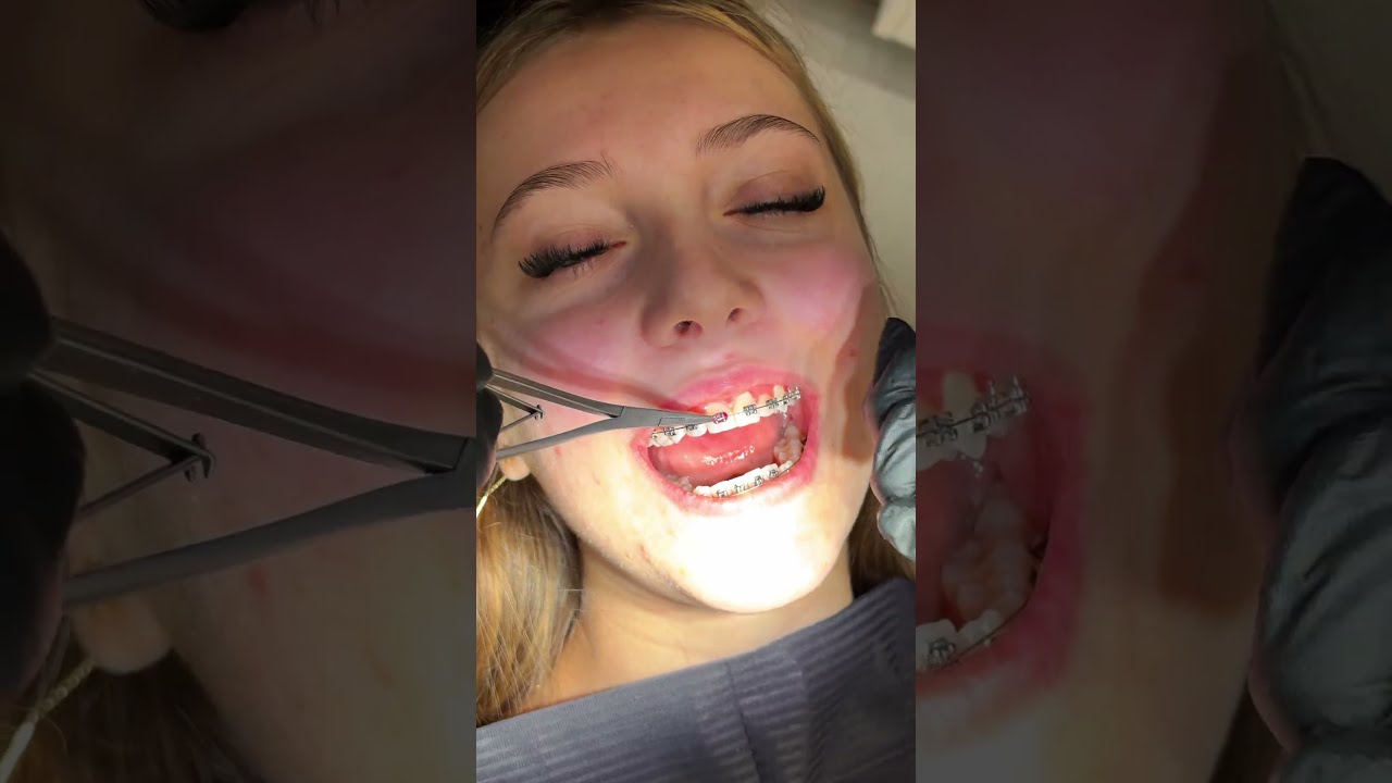 Schimbarea culorilor la HT Smile București