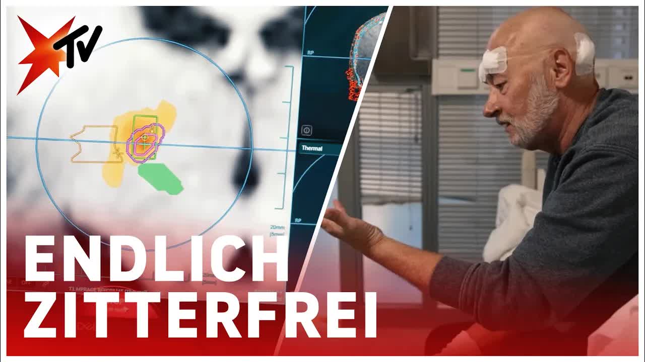 Zittern verschwindet nach Ultraschallbehandlung