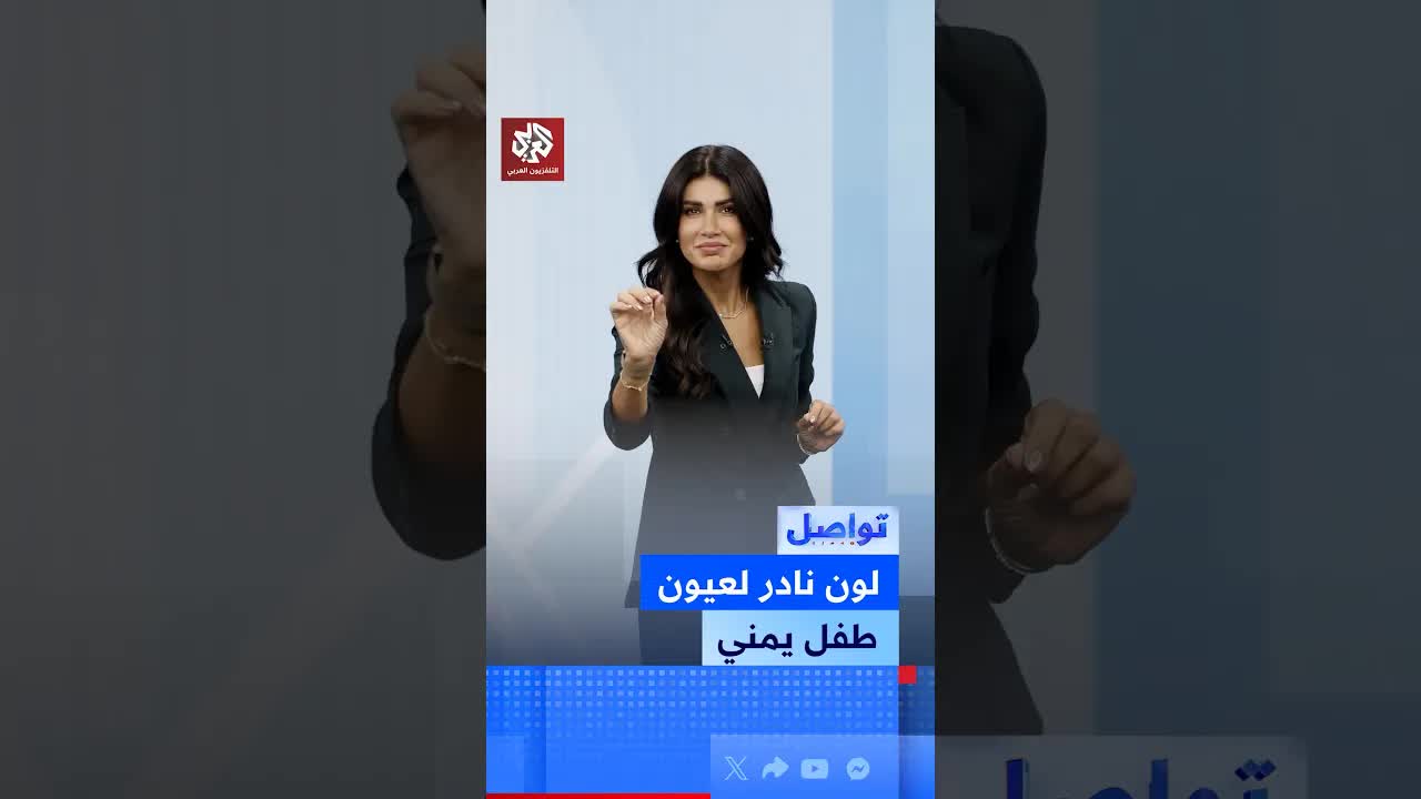 طفل يمني يشتهر بسبب عيونه الفيروزية