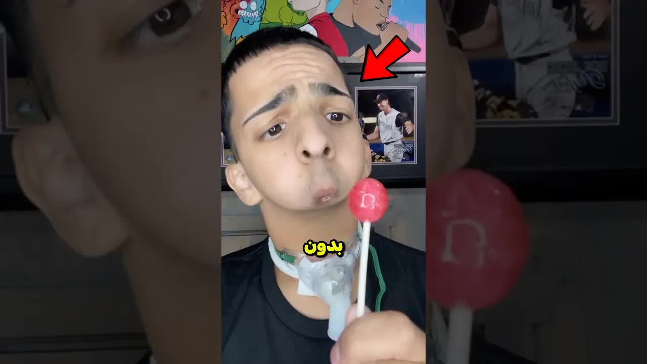 ولد بدون ذقن وجد طريق النجاح عبر الموسيقى