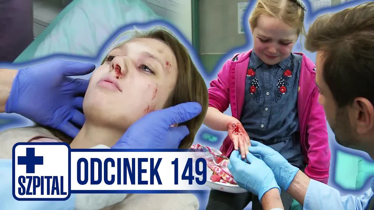 Dziewczynka pogryziona przez małpkę w zoo