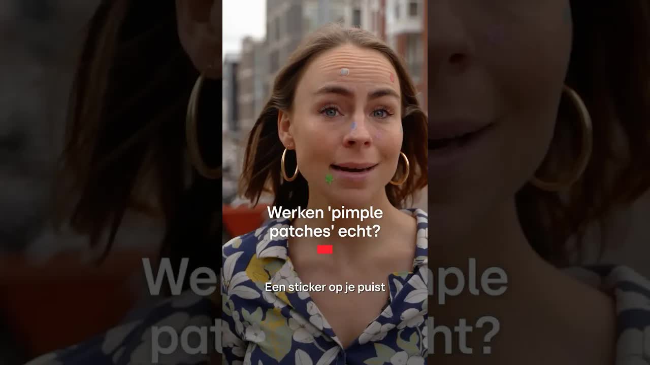 Werken pimpel patches echt tegen puistjes?