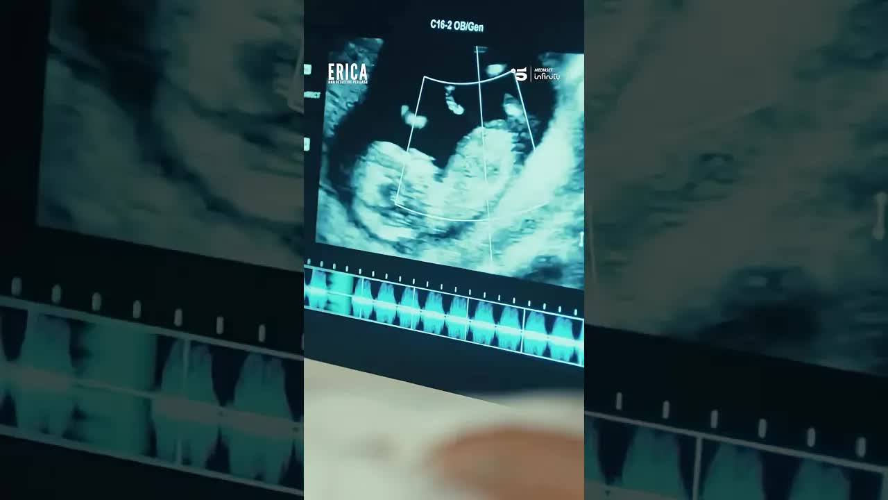Visita medica e diagnosi di diabete gestazionale