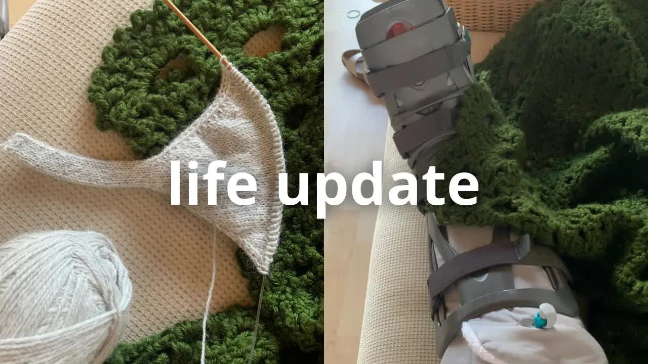 Broke my leg and adapting life in Germany