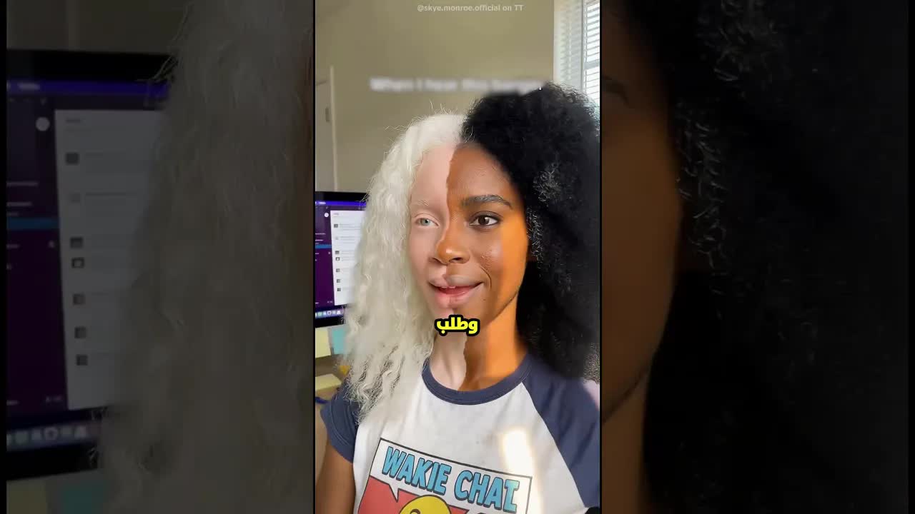 بنت نصها أبيض ونصها أسود تكتشف جمالها