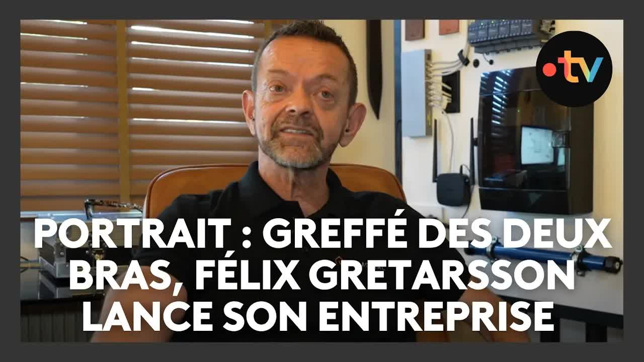 Félix, greffé des deux bras, lance son entreprise