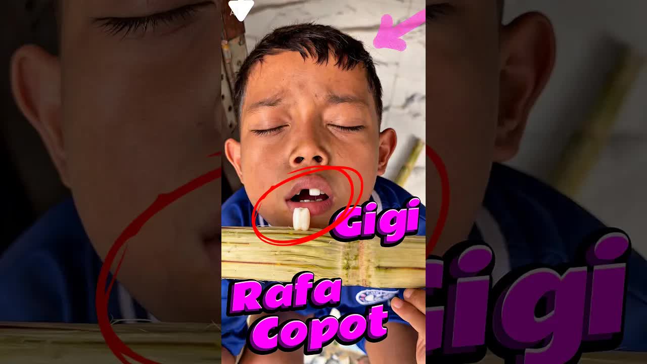 Gigi Rafa Copot Saat Makan Tebu