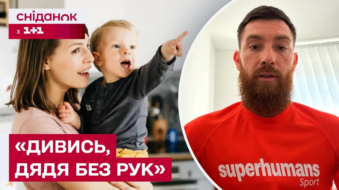 Як правильно говорити з дітьми про ампутації та протези