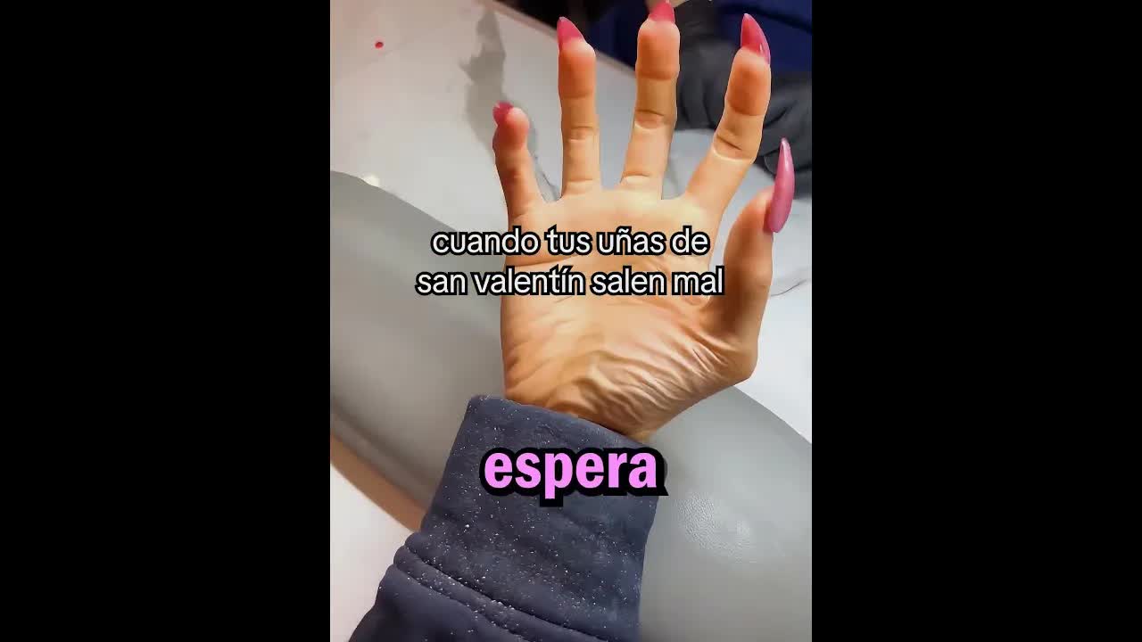 La uña torcida era el dedo