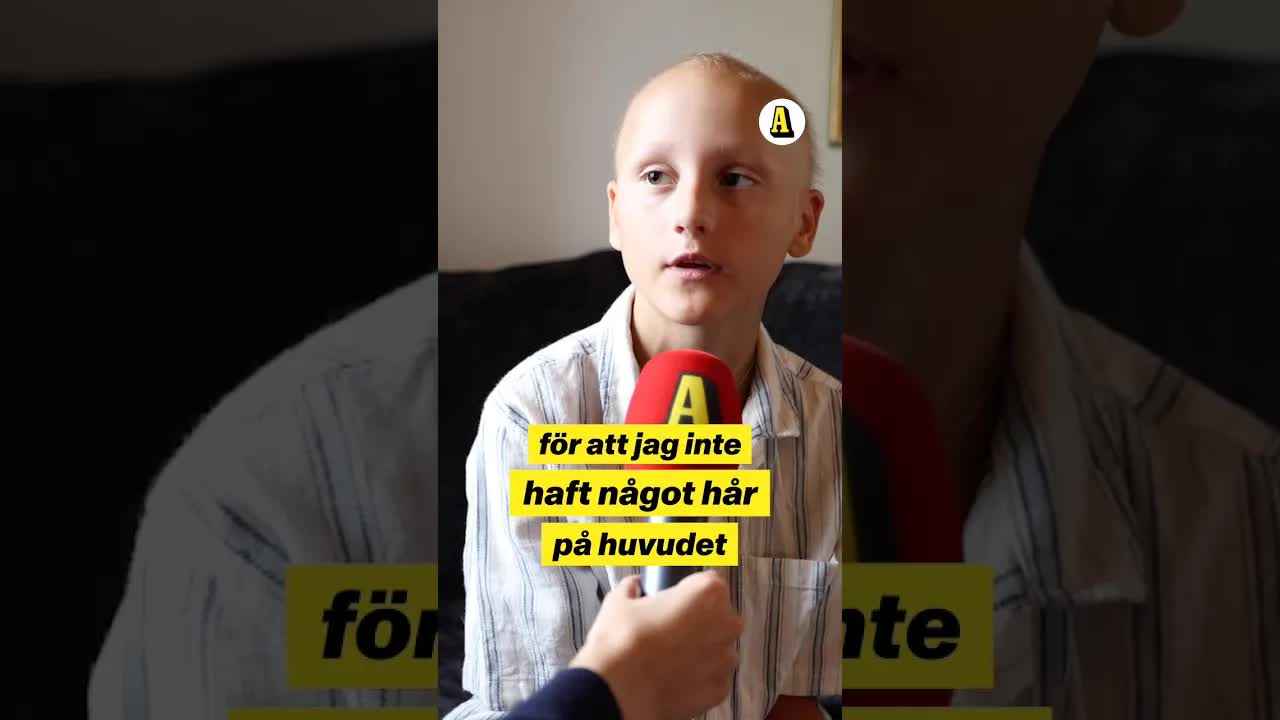 Wilhelm får medicin mot alopecia
