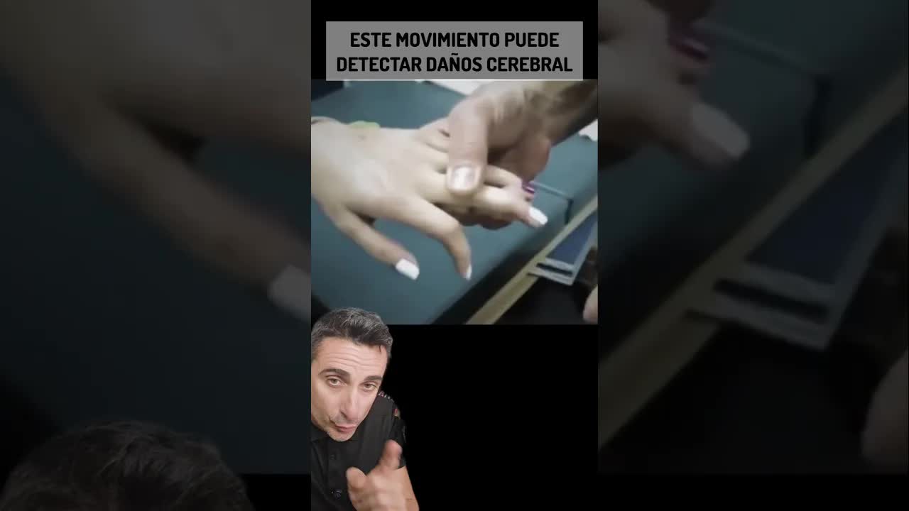 El reflejo de Hoffman y el sistema nervioso