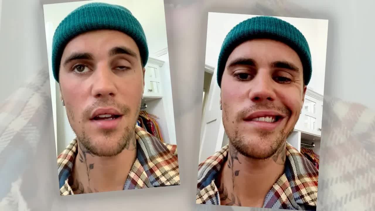 Justin Bieber felépült, buli lesz a Szigeten