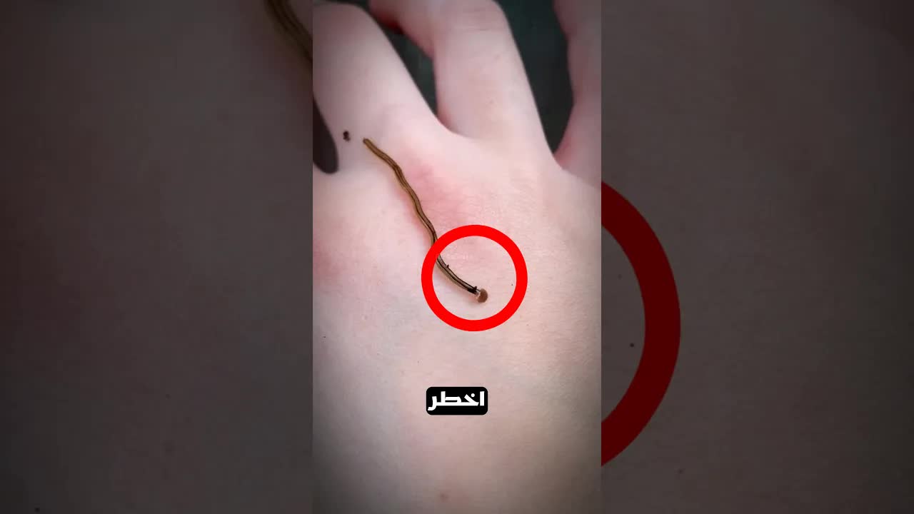 هل تعلم أن هذه أخطر دودة؟