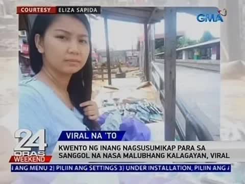 Inang nagsusumikap para sa malubhang maysakit na sanggol